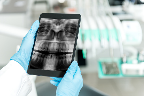 Gloved hands holding tablet with Digital X-rays Dental Technology from Cooley Smiles