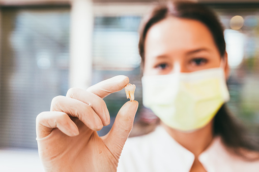 Dentist holding an extracted tooth Dentist holding an extracted tooth