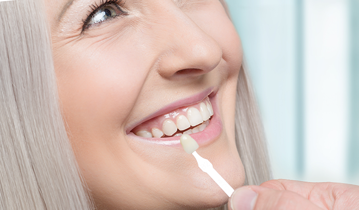 A woman with dental veneers smiles at Hoffman Dental in Hillsboro, OR