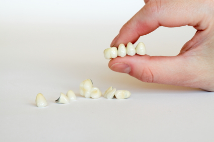 Man hand holding a dental bridge spare teeth at Neu Family Dental
