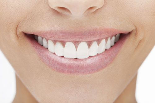Woman smiling and showing off her Porcelain Veneers from Cooley Smiles in Everett, WA