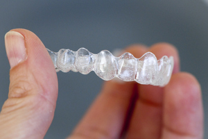 Hand holding Invisalign clear aligner tray from Cooley Smiles in Everett, WA