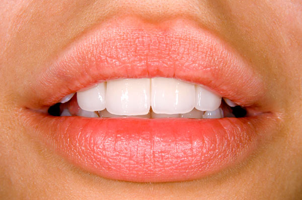 Beautiful teeth with dental bonding at Hoffman Dental in Hillsboro, OR