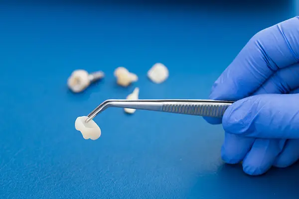 Dental crown held by tweezers with dental tools and a model on a blue background at Hoffman Dental in Hillsboro, OR