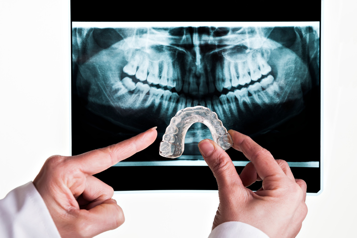 hands holding a mouth guard in front of a digital xray of the mouth